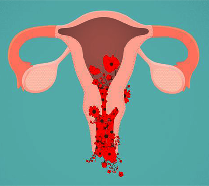 Abnormal Uterine Bleeding Treatment Cost in Kolathur