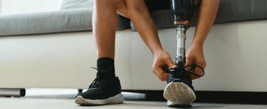 Amputation Surgery in Kolathur