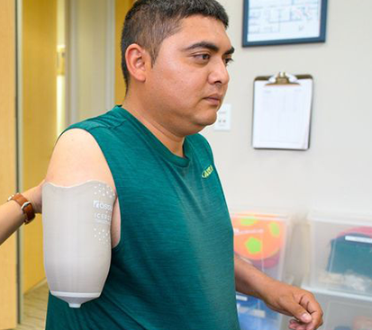 Amputation Surgery Cost in Kolathur