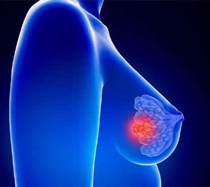 Breast Abscess Treatment in Kolathur