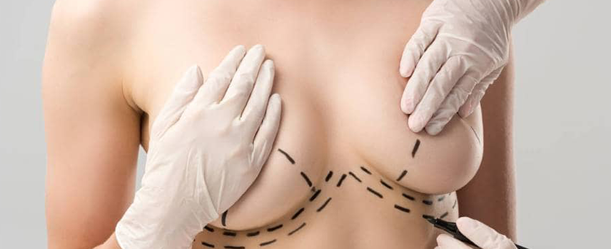 Breast Cancer Surgery in Kolathur
