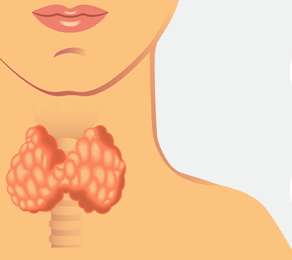 Colloid Goitre Surgery in Mogappair