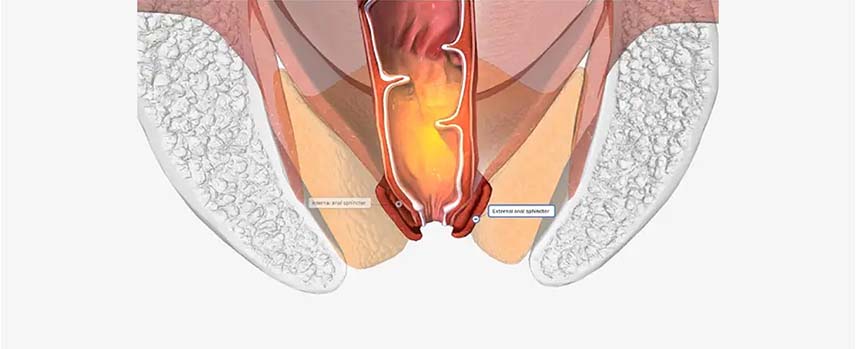 Best Fistula Treatment in Mogappair