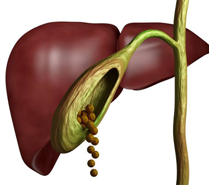 Gallbladder Stone Treatment in Mogappair