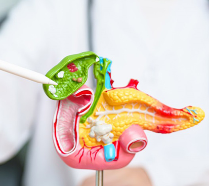 Gall Bladder Stone Surgery in Kolathur