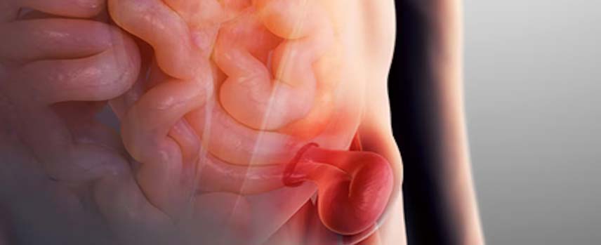 Hernia Surgery in Kolathur