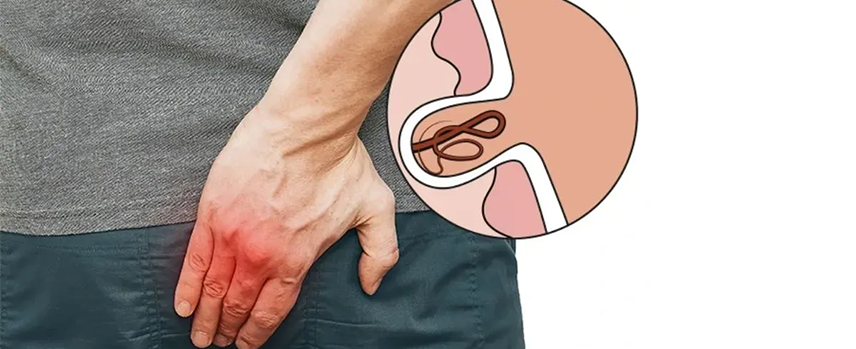 Pilonidal Sinus Surgery in Kolathur