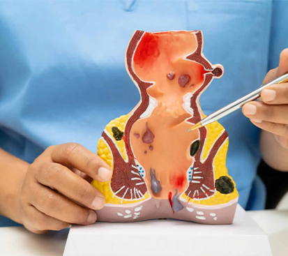 Pilonidal Sinus Treatment in Mogappair