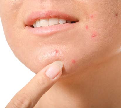 Sebaceous Cyst Treatment Cost in Kolathur