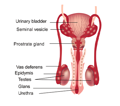 Hydrocele Surgery in Kolathur