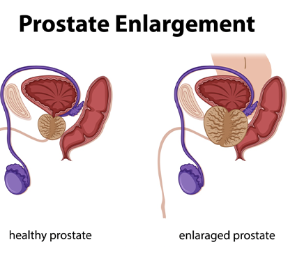 Swollen Penis Surgery in Kolathur