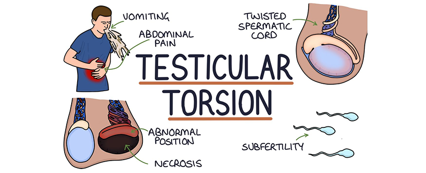 Testicular Torsion Treatment in Kolathur