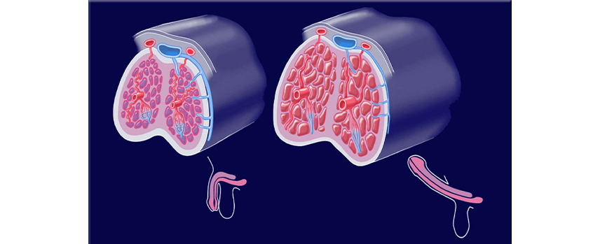 Balanitis and Balanoposthitis Treatment in Kolathur