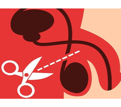 Vasectomy Surgery Cost in Mogappair