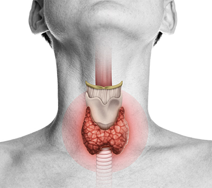 Thyroidectomy Treatment in Mogappair